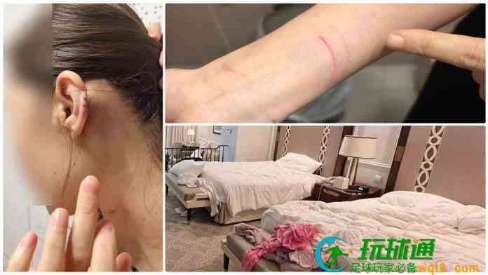 無業漢1小時內先在酒店房姦劫女賭友 再扮換錢黨毆劫兩女終落網